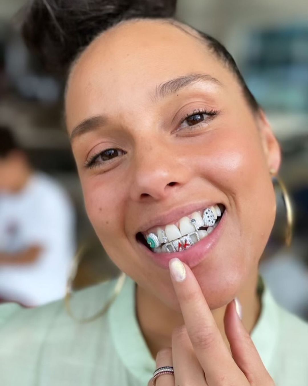 Grillz: O acessório dental que está em alta! Confira origens, estilos e cuidados