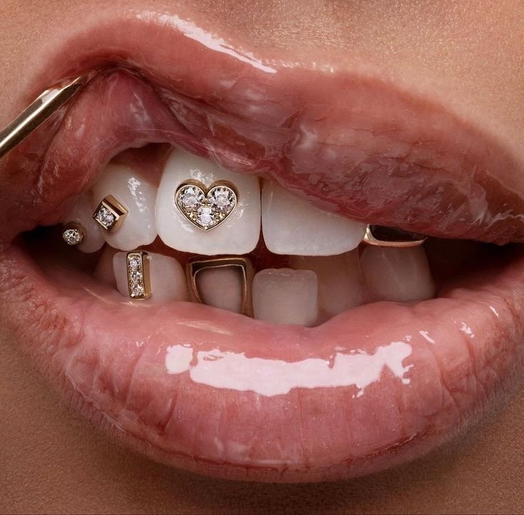 Grillz: O acessório dental que está em alta! Confira origens, estilos e cuidados